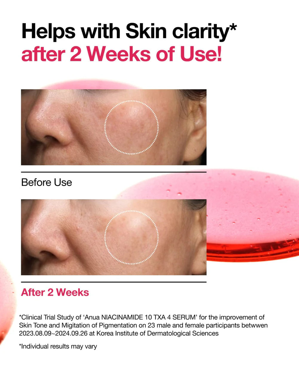 Anua Niacinamide 10% + TXA 4% Serum